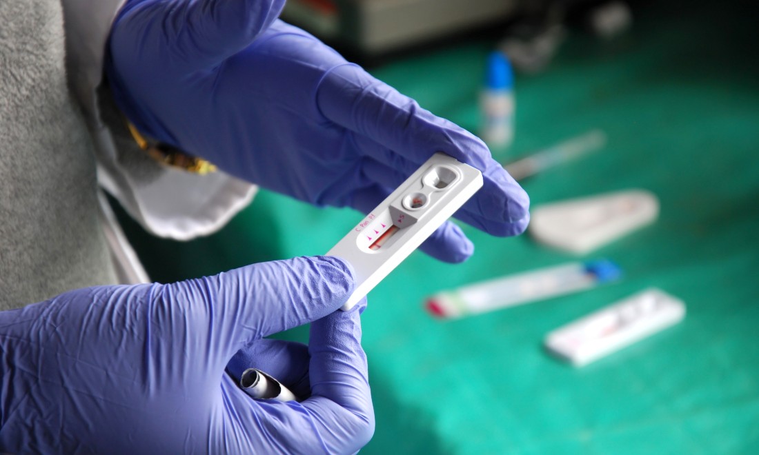 Düsseldorf patient declared HIV-free following stem cell transplant